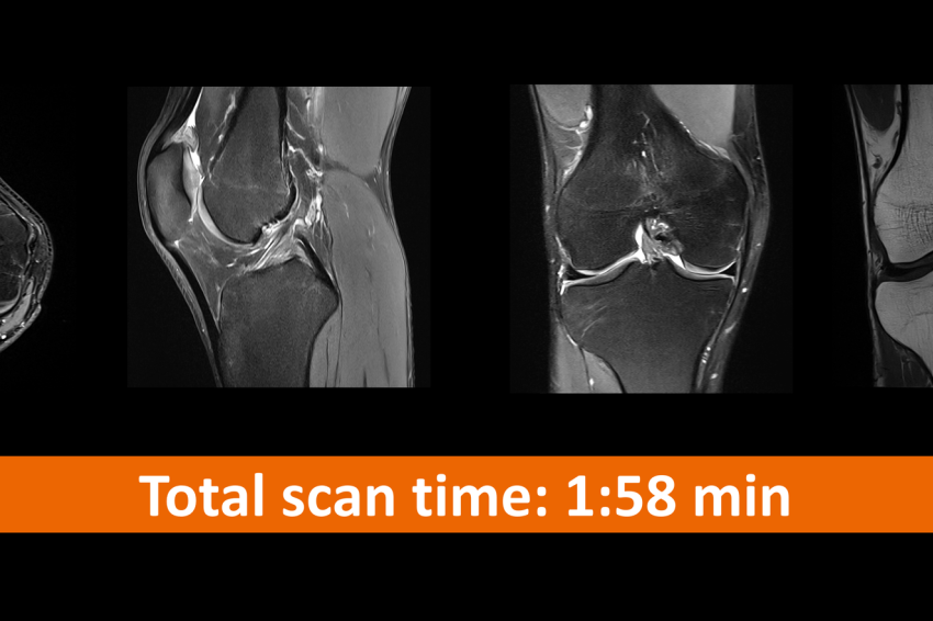RMN pelvis nativ timp scanare scurt